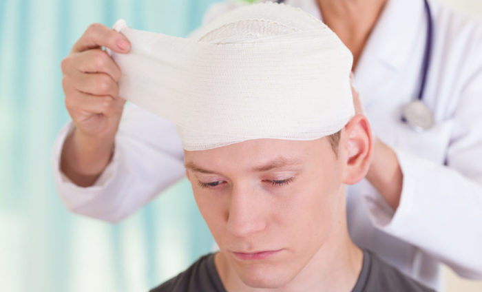 Work Injury Damages Claim Burns from Explosion